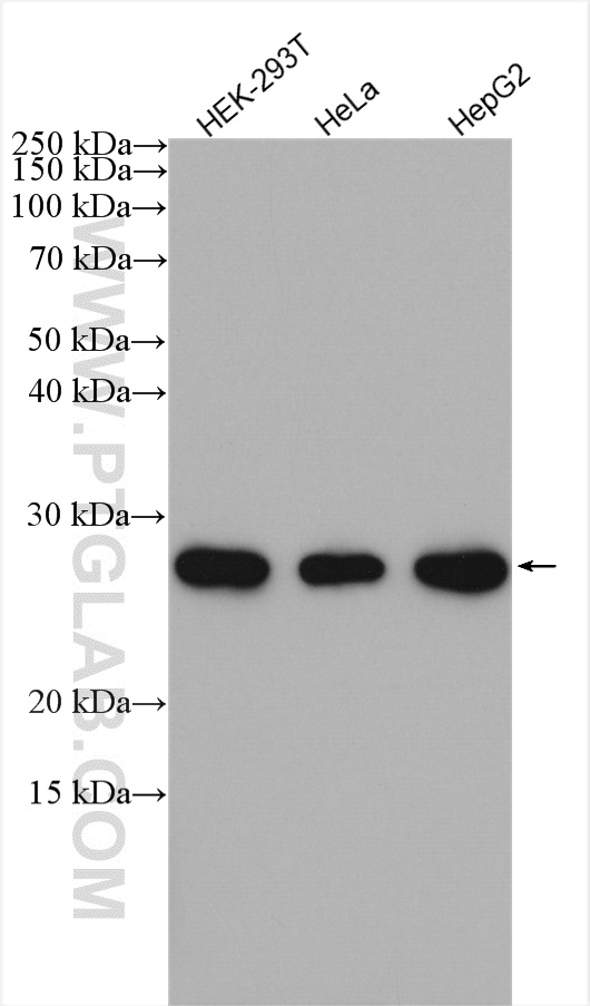 SPC24 Polyclonal antibody