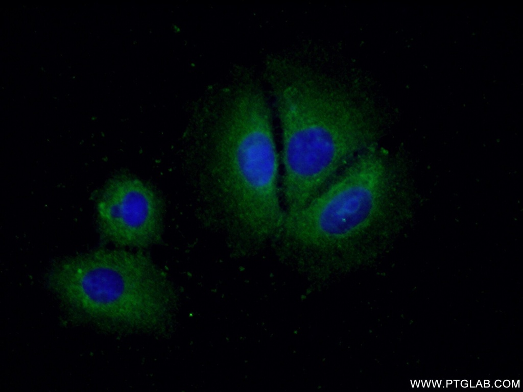 CCM2 Polyclonal antibody