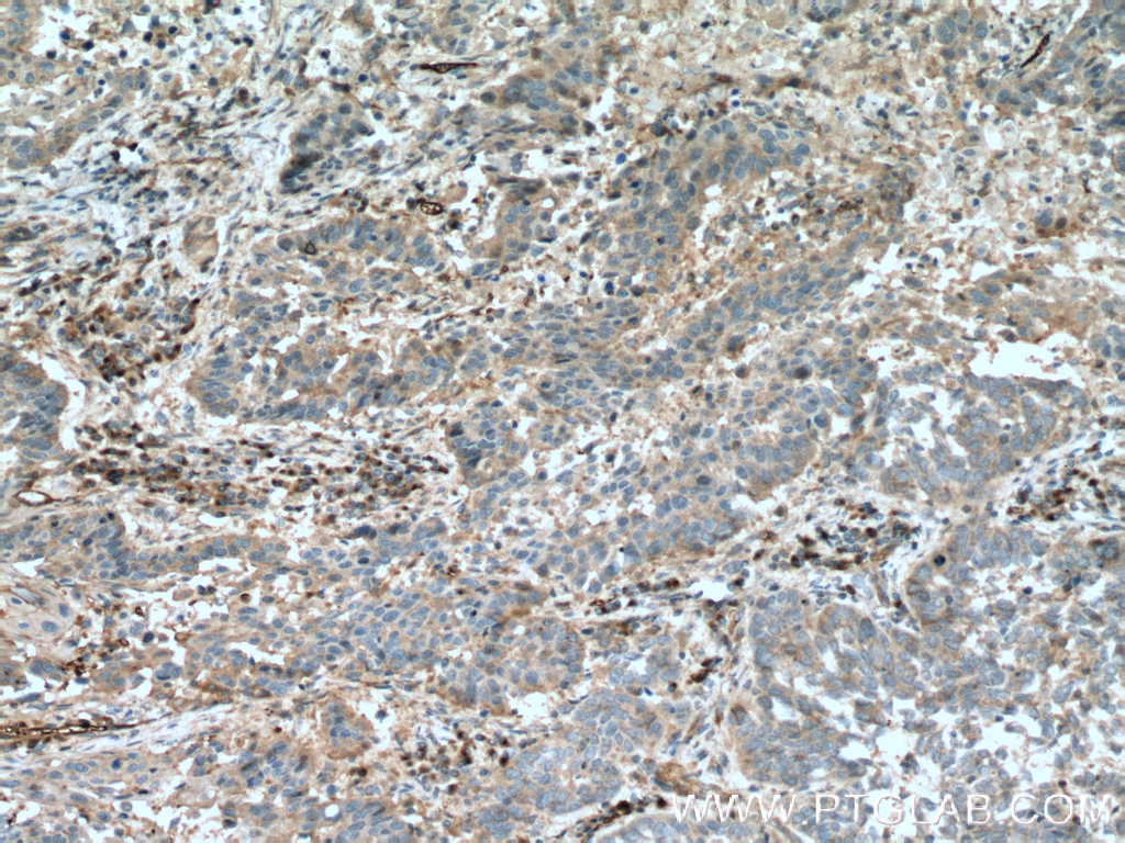 FGF21 Polyclonal antibody