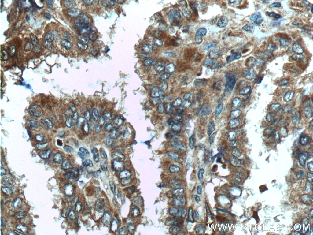C8orf4 Polyclonal antibody
