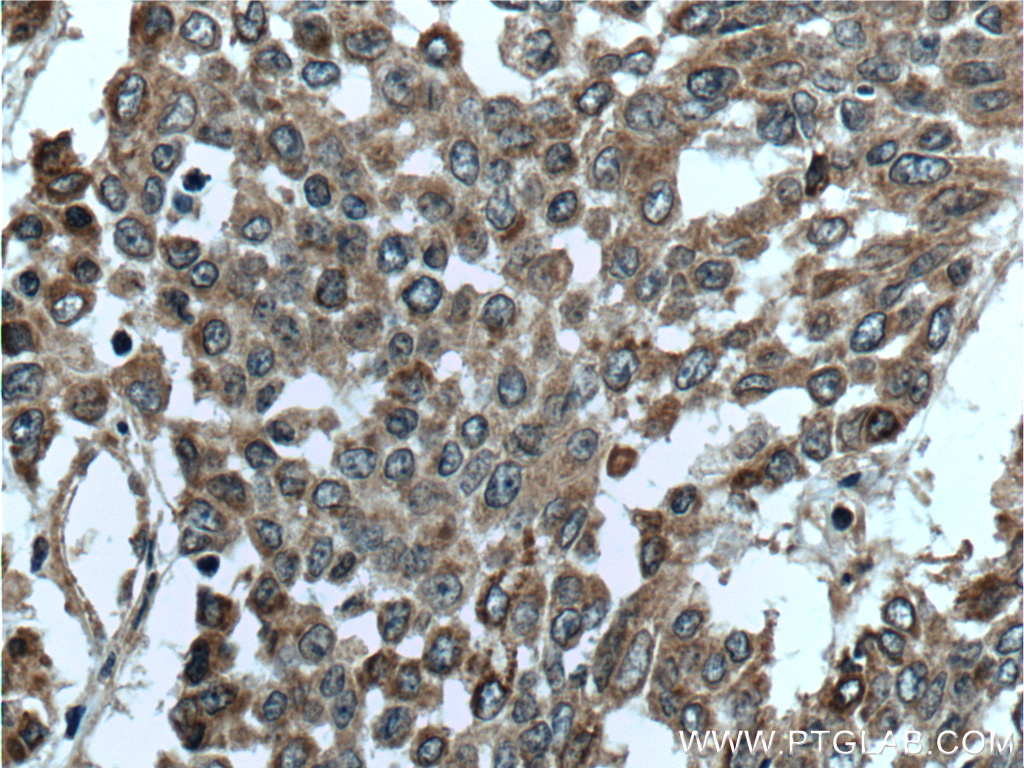 DALRD3 Polyclonal antibody