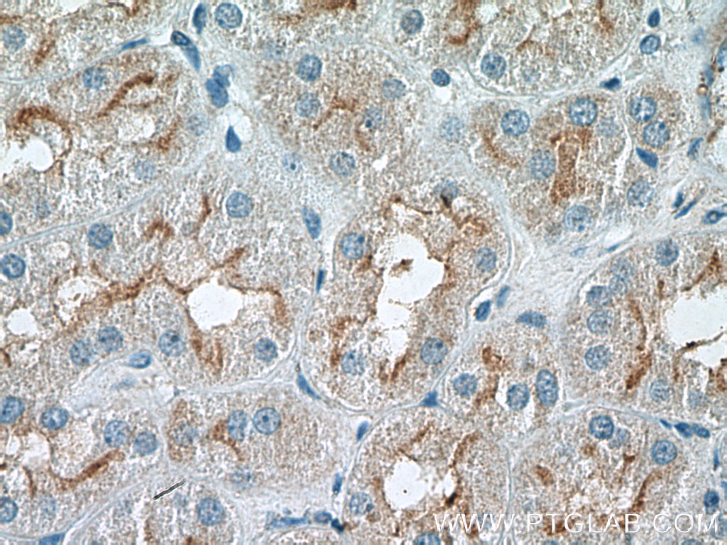 RNF144B/IBRDC2 Polyclonal antibody