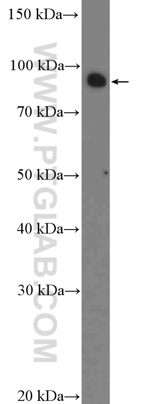 CCDC21 Polyclonal antibody
