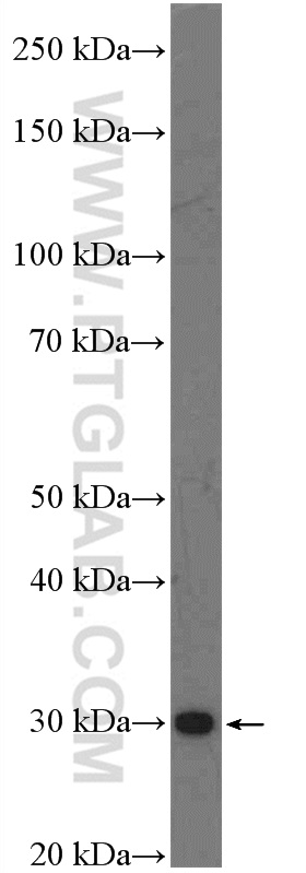 C1orf71 Polyclonal antibody