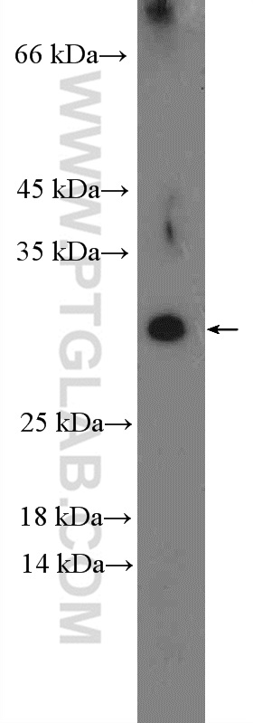 DYDC1 Polyclonal antibody