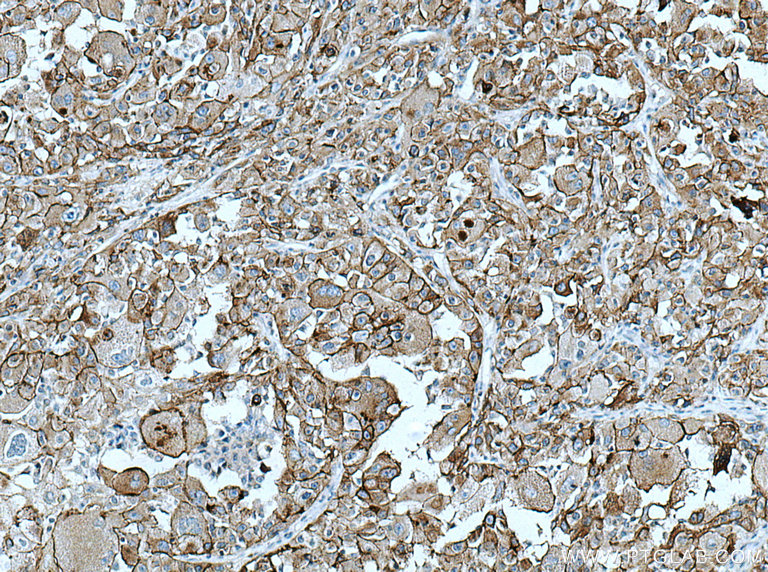AE2 Polyclonal antibody