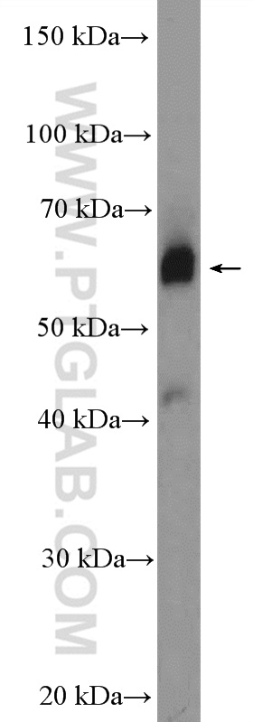 ZNF169 Polyclonal antibody