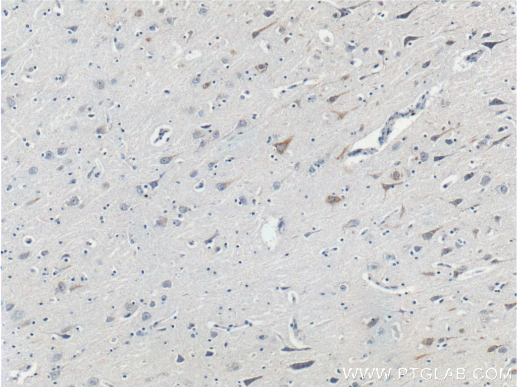 Neurofascin Polyclonal antibody