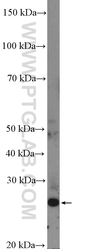 FLJ14213 Polyclonal antibody