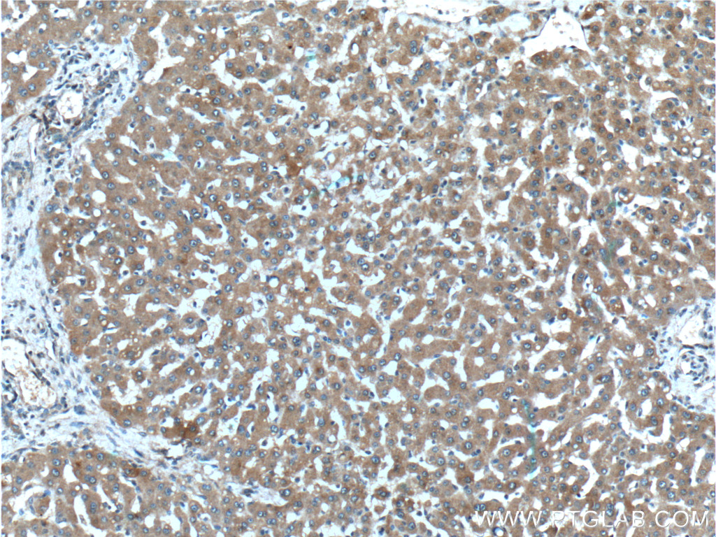 F2R Polyclonal antibody