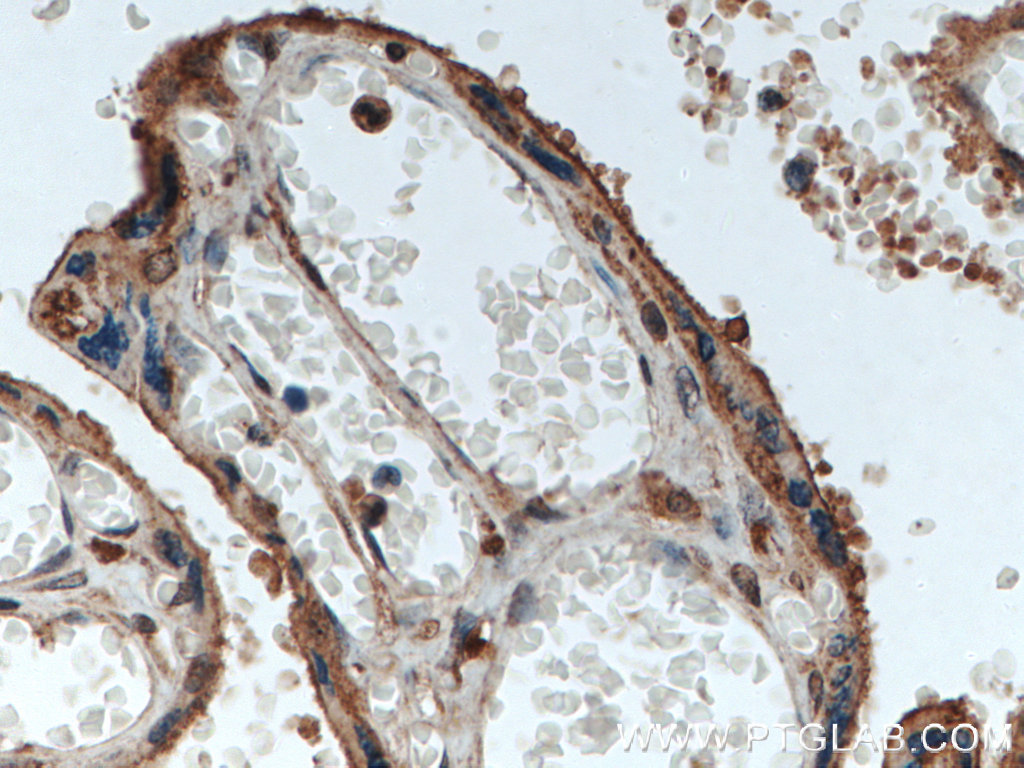 RBCK1 Polyclonal antibody