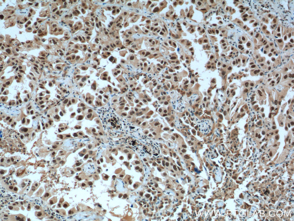 CCDC59 Polyclonal antibody