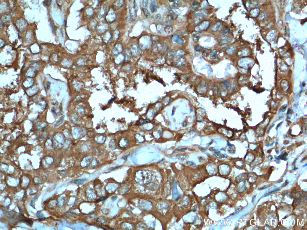 LHCGR Polyclonal antibody