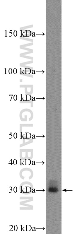 Enkurin Polyclonal antibody
