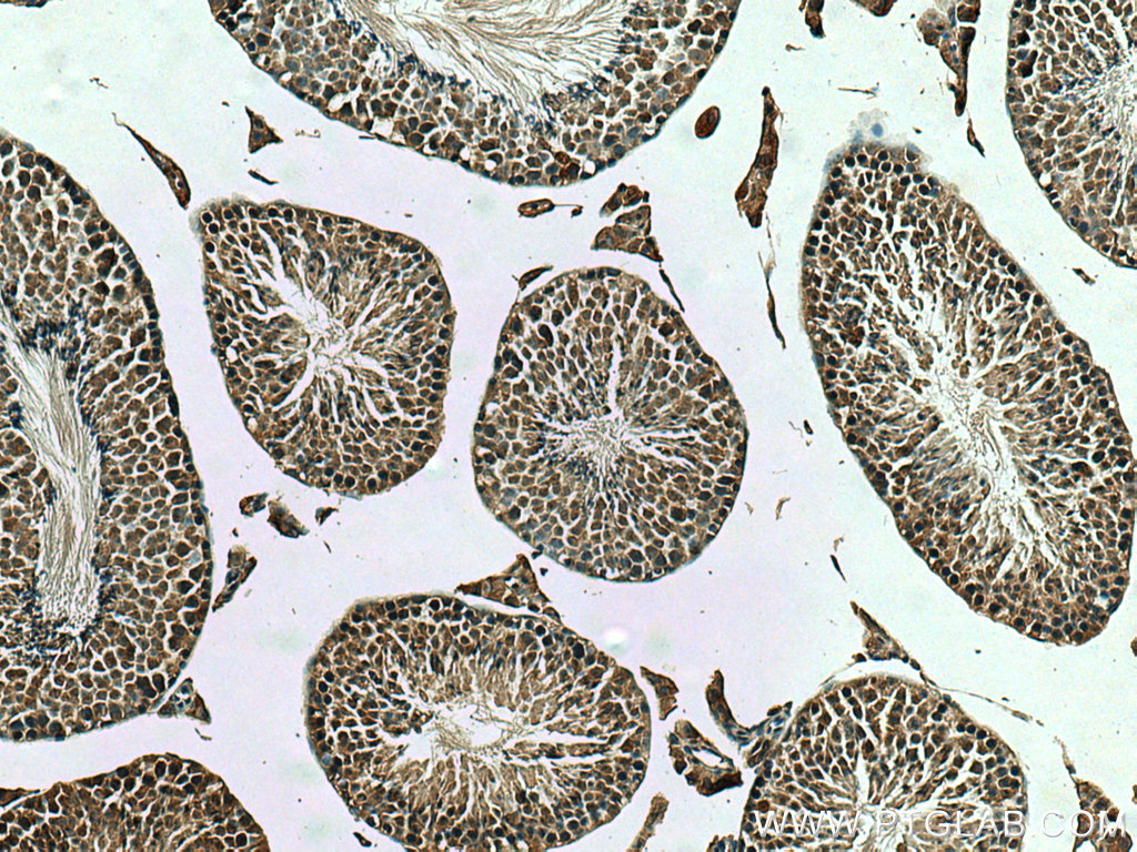 TMEM97 Polyclonal antibody
