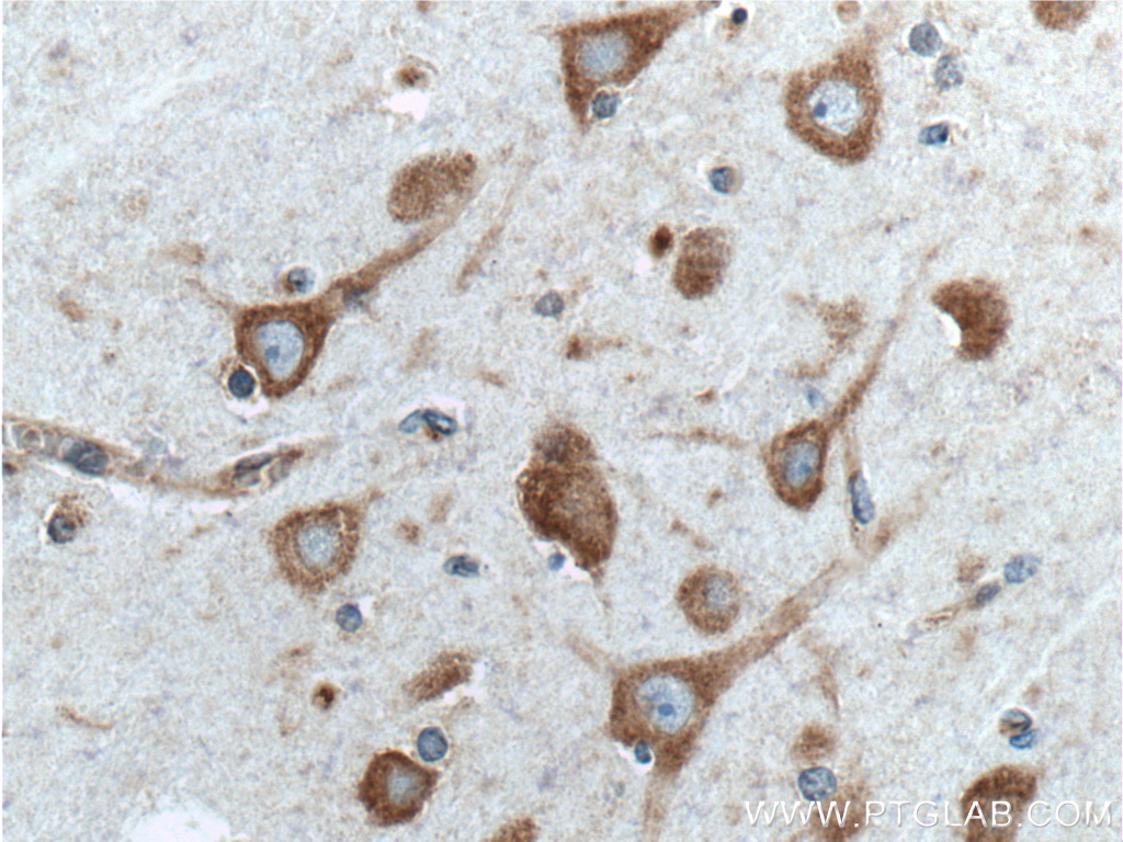 NME7 Polyclonal antibody