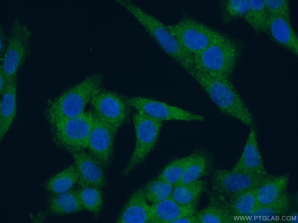 Ch-TOG Polyclonal antibody