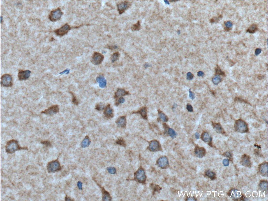 GALR2 Polyclonal antibody