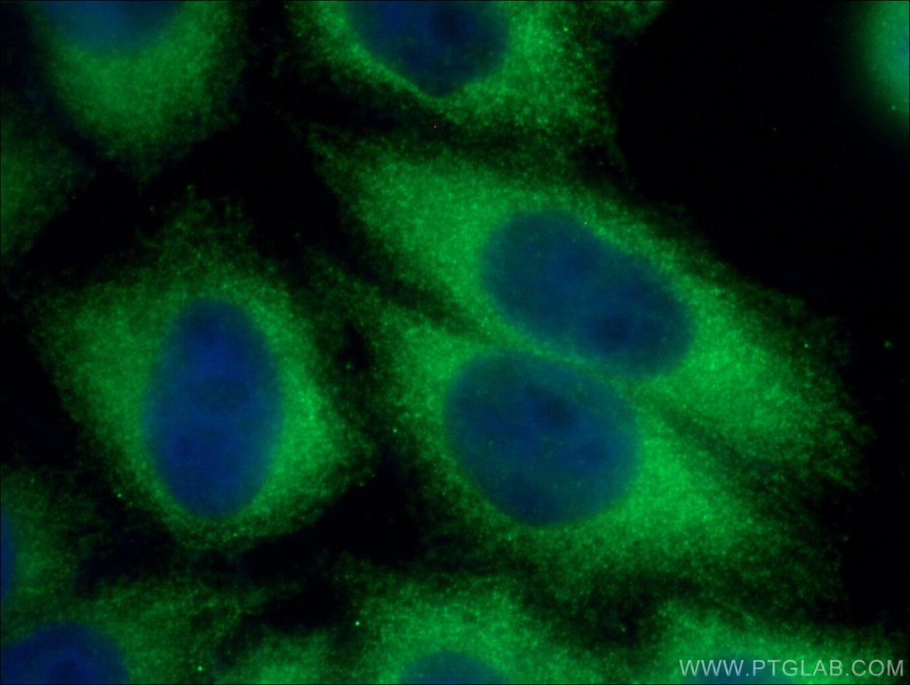 SFRP1 Polyclonal antibody