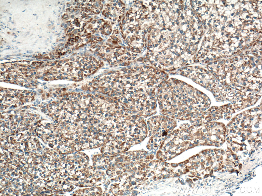 OTC Polyclonal antibody