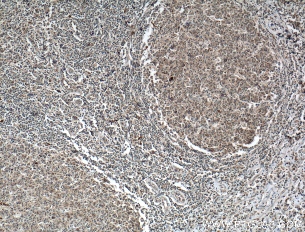CD62L Polyclonal antibody