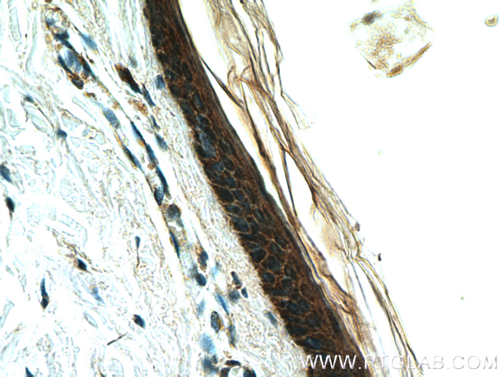 LCE2B Polyclonal antibody