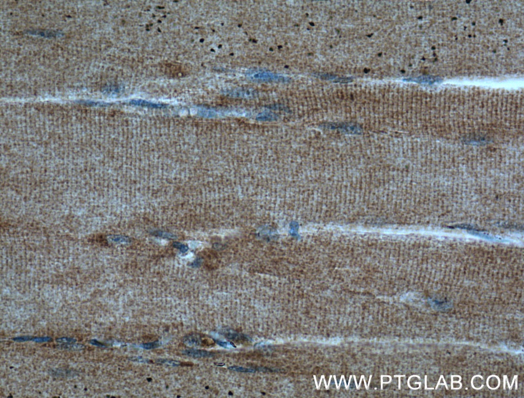 DIO2 Polyclonal antibody