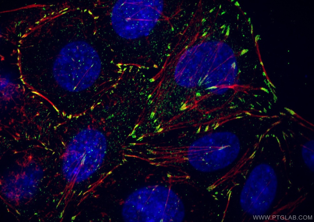 Vinculin Polyclonal antibody