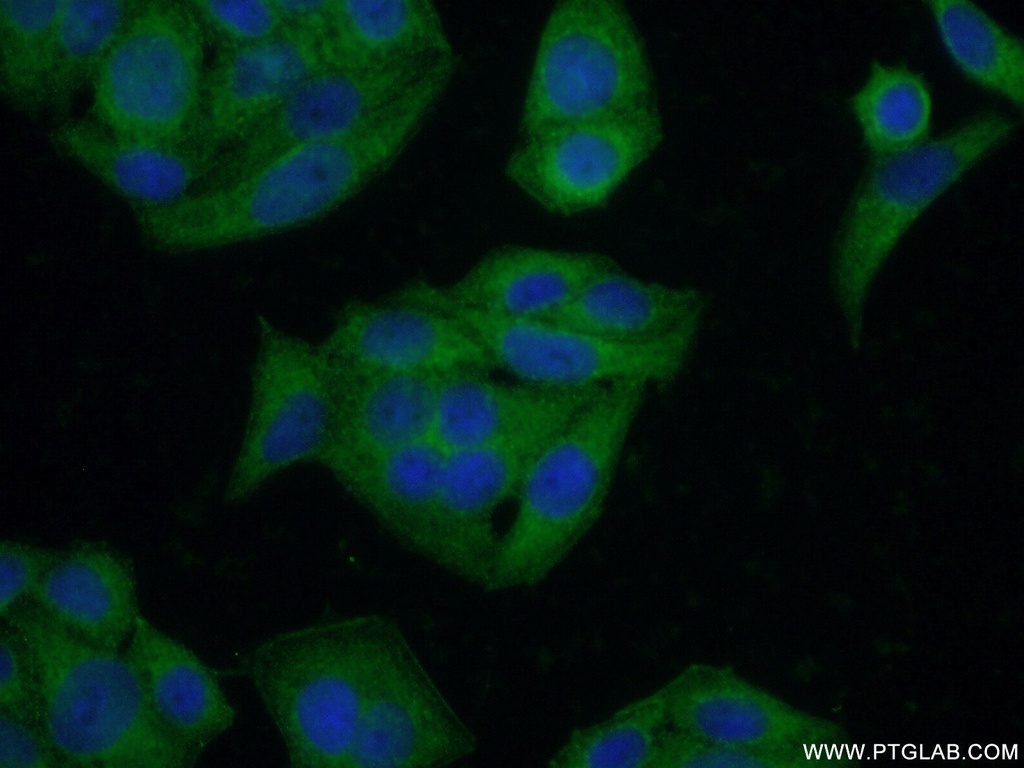 CLTC Polyclonal antibody