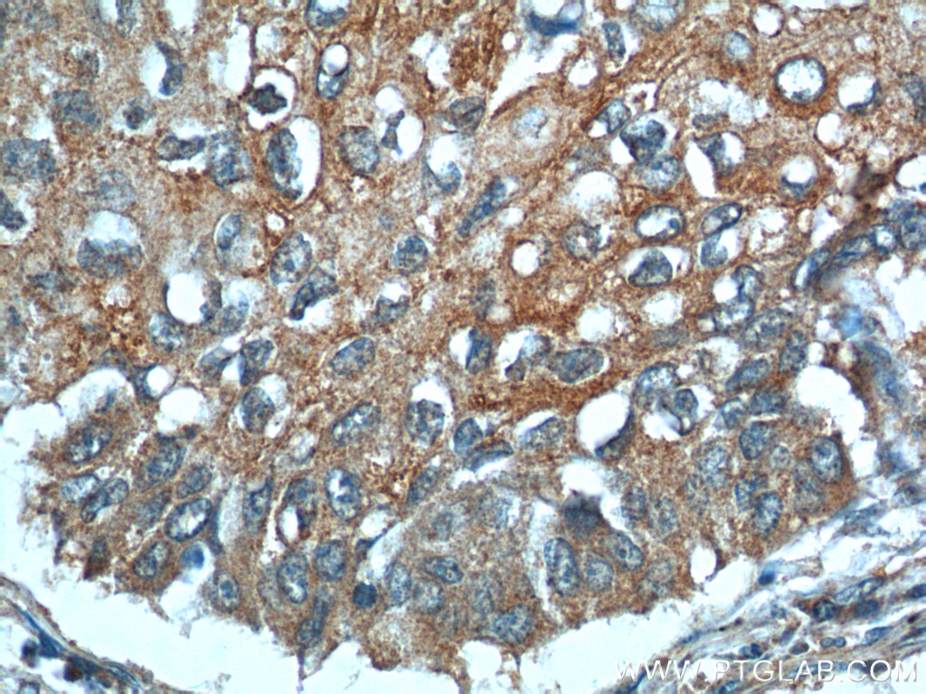 MIP-3 Alpha Polyclonal antibody