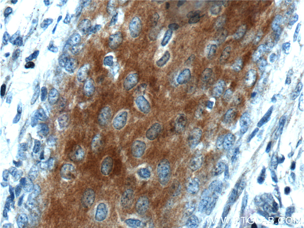 XYLB Polyclonal antibody
