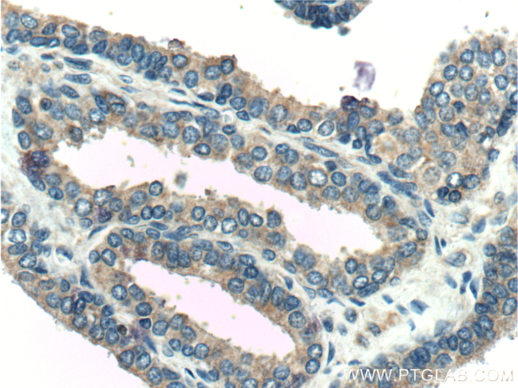 KLK4 Polyclonal antibody
