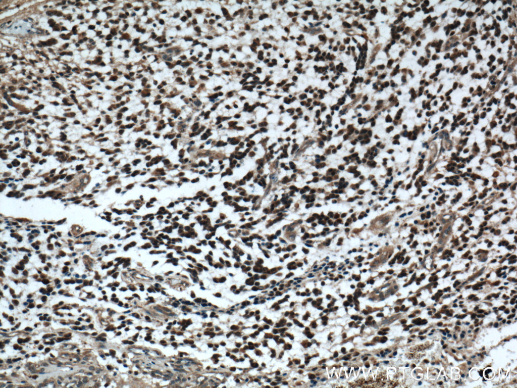 Phospholipase C Beta 1 Polyclonal antibody