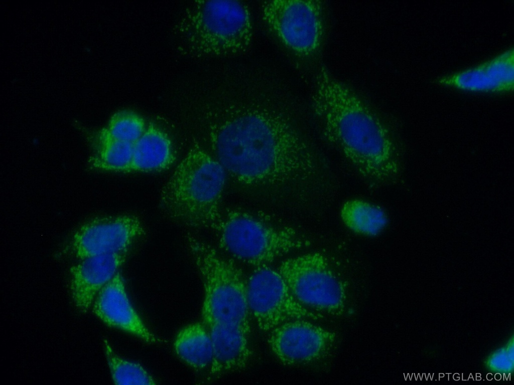 FGF9 Polyclonal antibody
