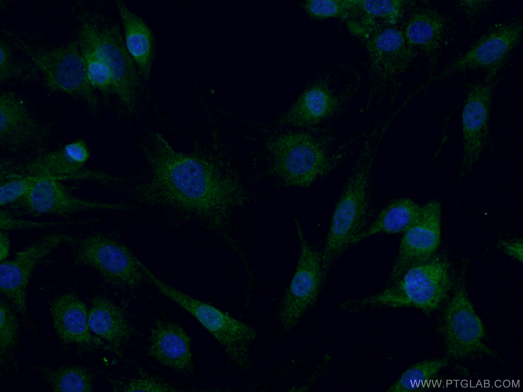 CPT2 Polyclonal antibody