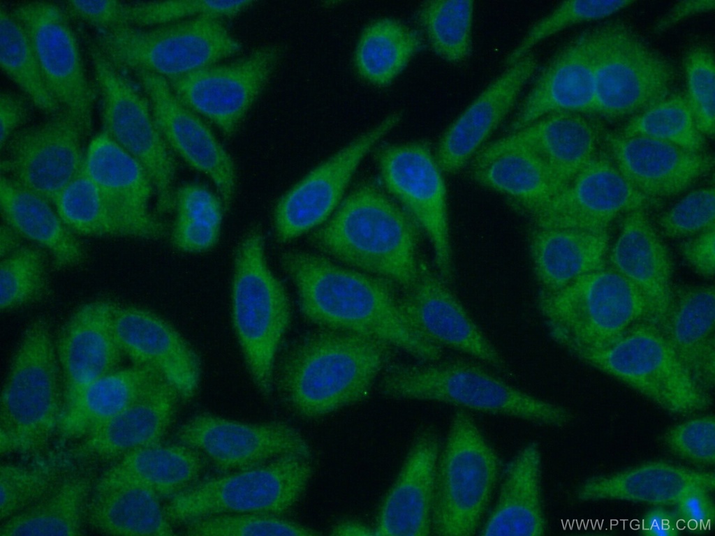 EHHADH Polyclonal antibody