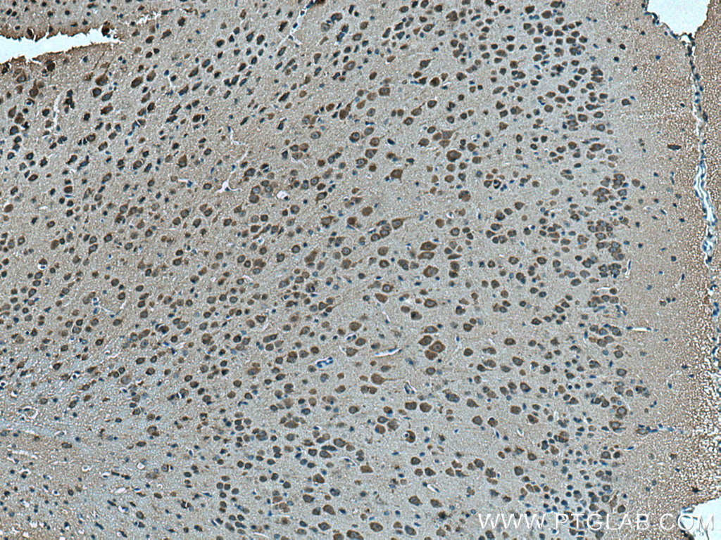 OAT1 Polyclonal antibody