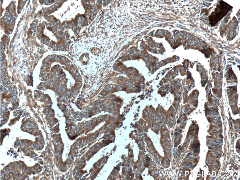 ST13 Polyclonal antibody