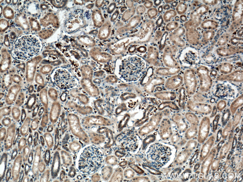 SCF Polyclonal antibody