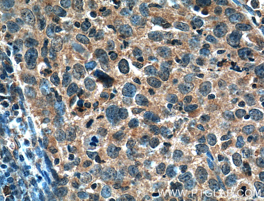 MMP1 Polyclonal antibody