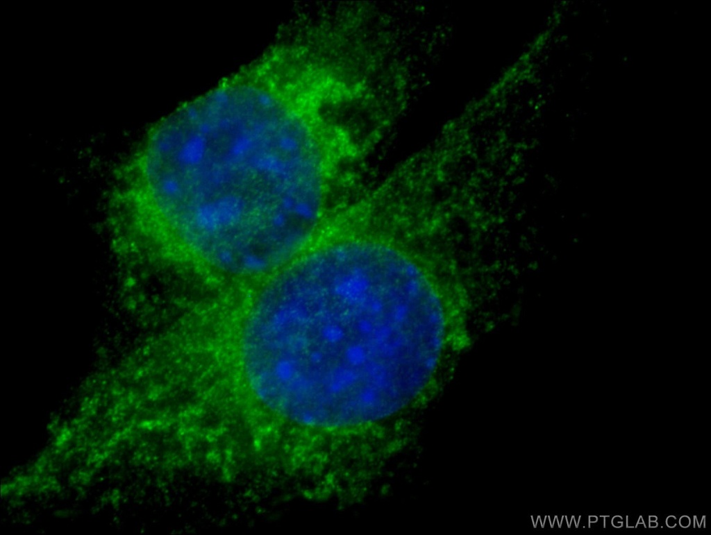 Bcl2 Polyclonal antibody
