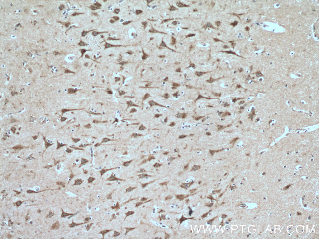 SIRPD Polyclonal antibody