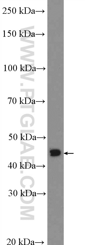 OTX1 Polyclonal antibody