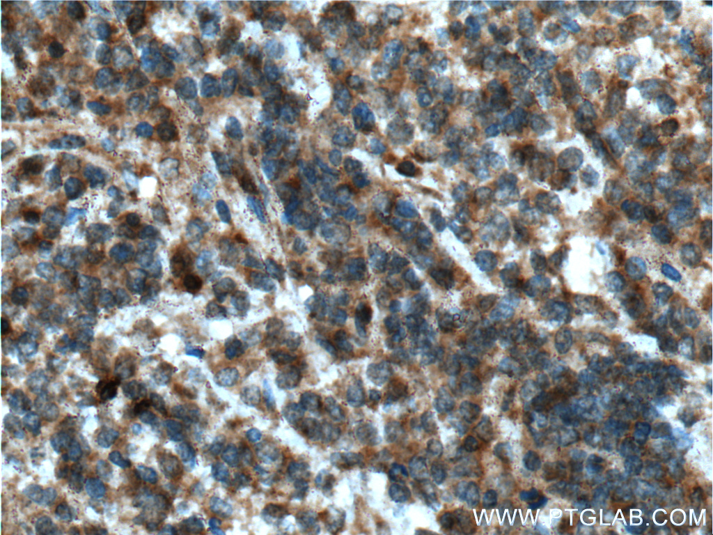 STK17B Polyclonal antibody