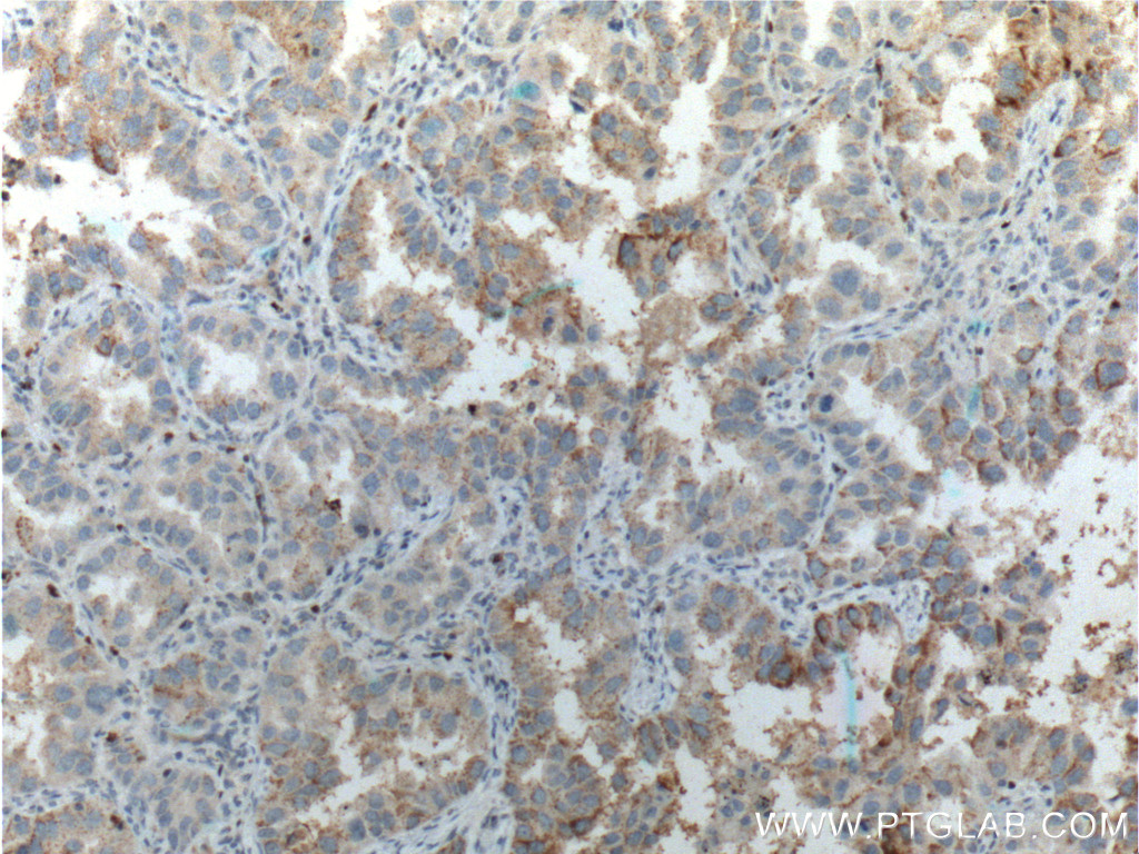 RHOV Polyclonal antibody