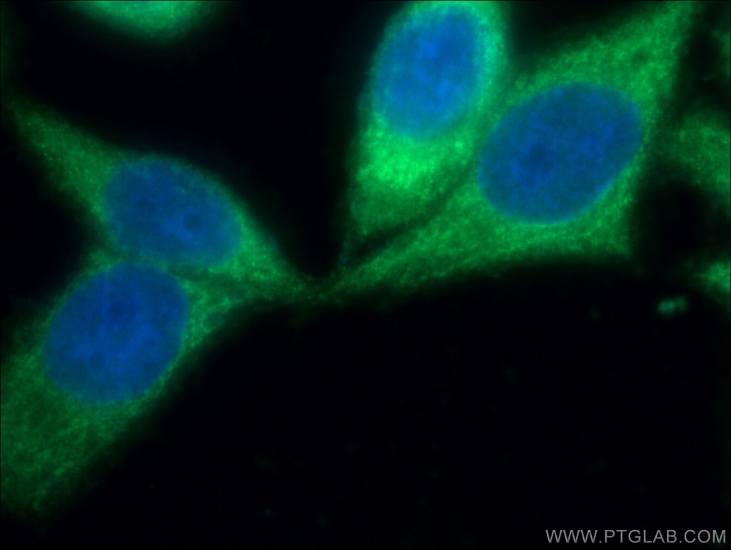 ALDH9A1 Polyclonal antibody