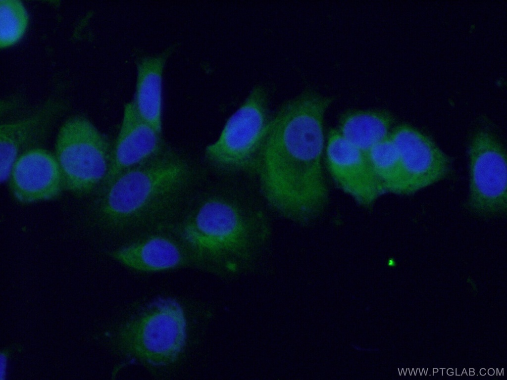 BAG5 Polyclonal antibody