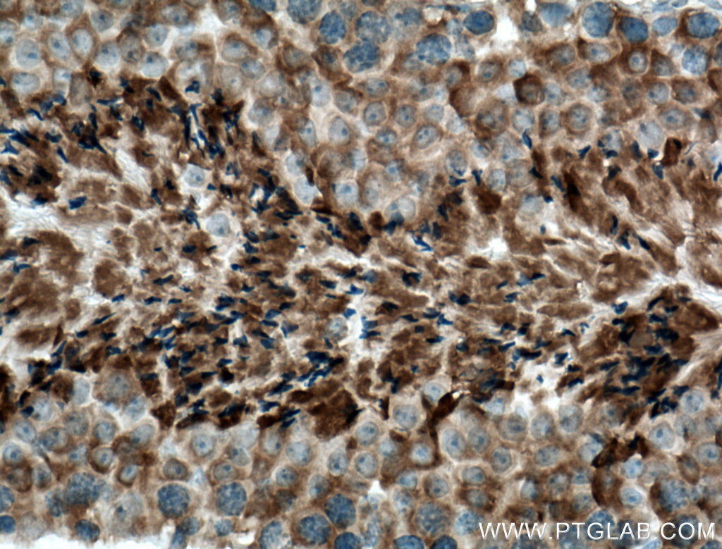 CLRN1 Polyclonal antibody