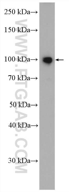 DRP2 Polyclonal antibody
