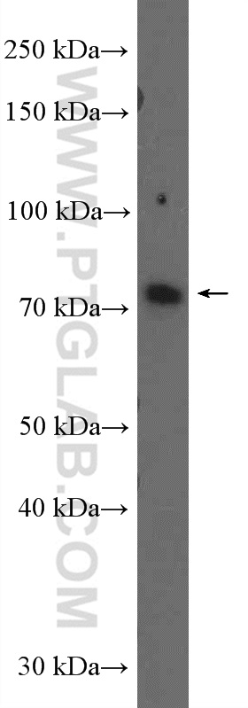 CATSPERB Polyclonal antibody